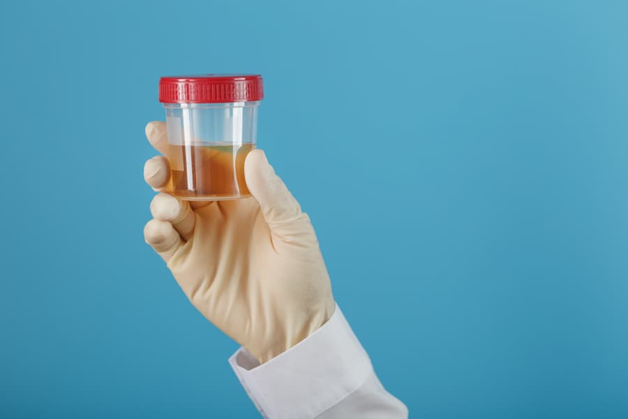 Hematuria 2